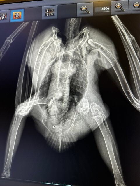 Röntgenbild der Oberschenkel-Fraktur