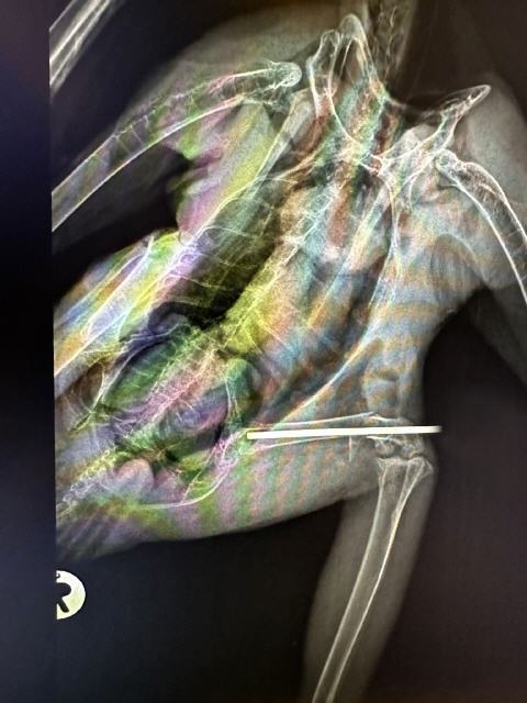 Zustand mit Implantat nach der Operation